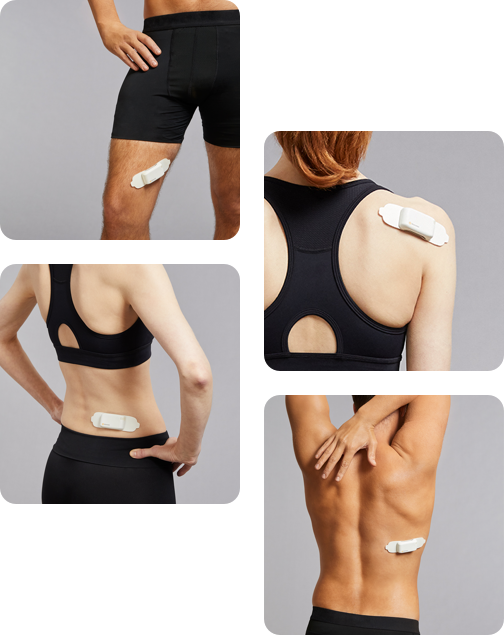 StimRouter PNS Targets Pain in Diverse Locations