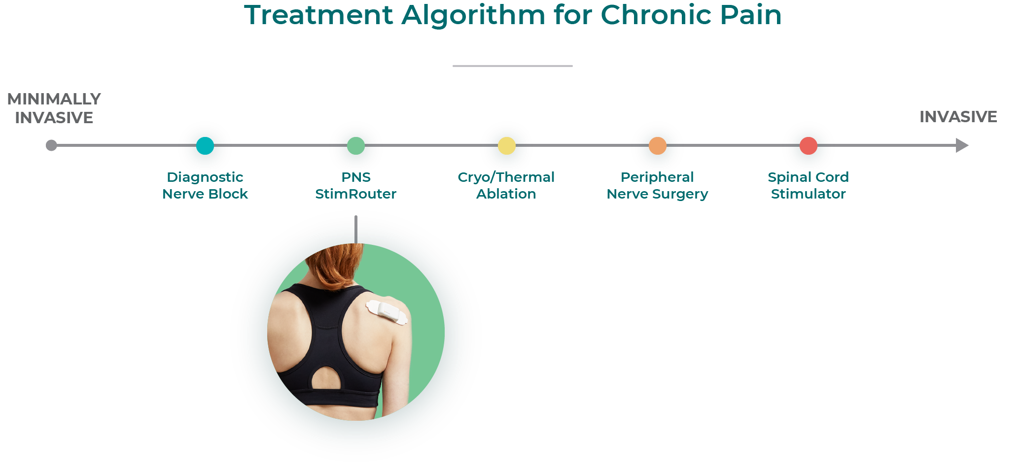 Chronic Pain Treatment Algorithm
